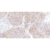 Anti -ki67-Kaninchen-PAB für Krebsforschung IHC, wenn primärer Antikörper