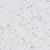 Anti -ngf-Kaninchen-PAB IHC, wenn ein polyklonaler Antikörper