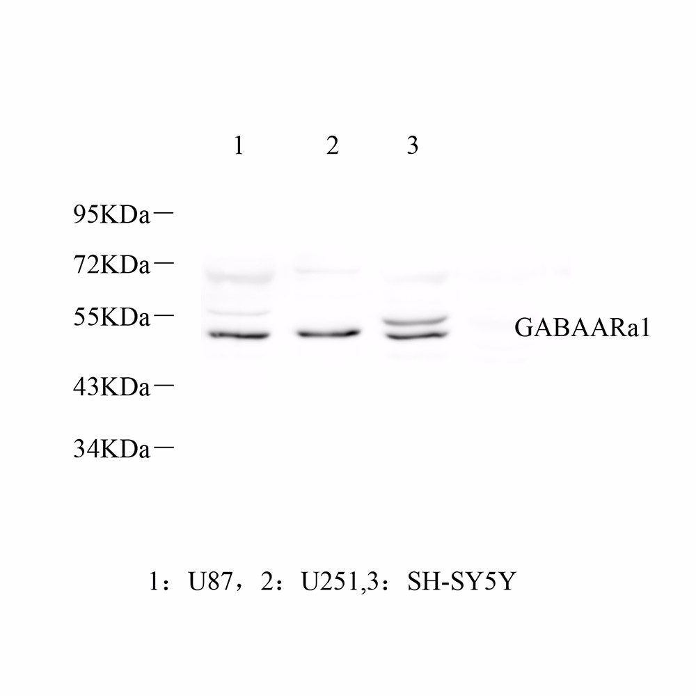 GB11561 Anti -Gaba A-Rezeptor Alpha 1 Kaninchen PAB